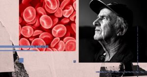Анализ крови, измеряющий биологический возраст, может выявить риск деменции