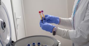 Новый анализ крови на основе РНК обещает более раннее обнаружение болезни Альцгеймера
